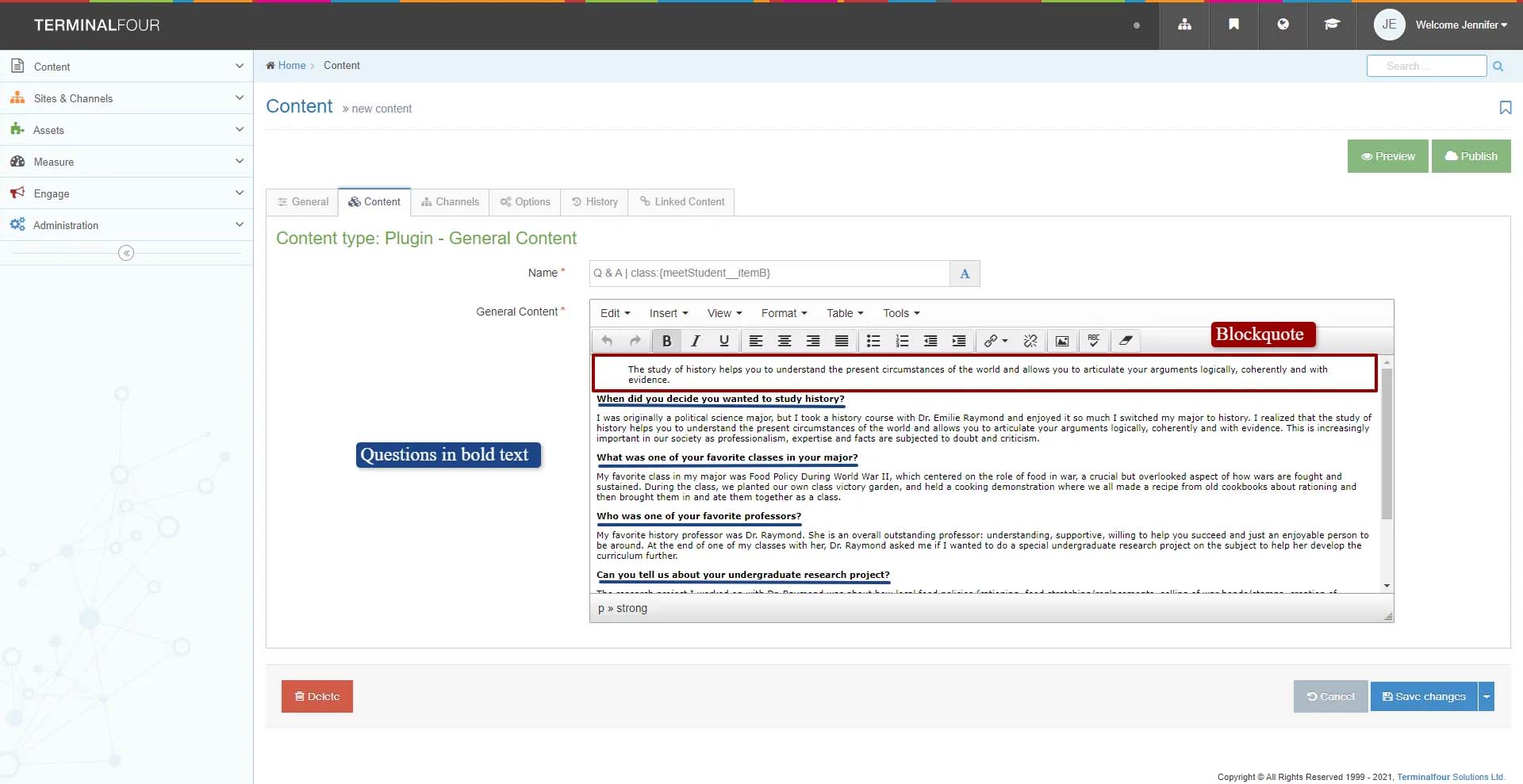 terminal four page view of the meet a student page indicating to web users to format the pullquote as a blockquote and the questions in the q and a section as bold